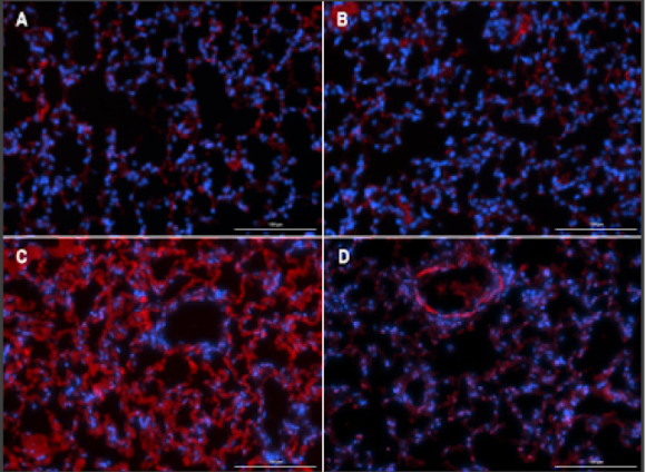 Alpha Smooth Muscle Actin