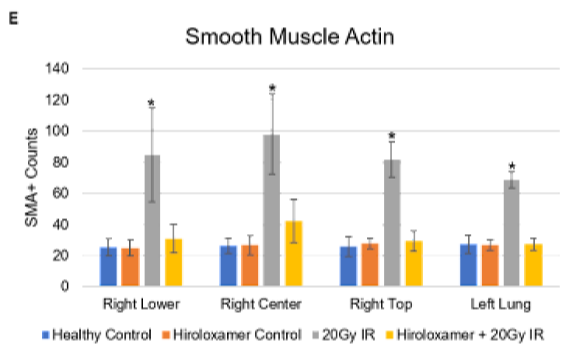 Smooth Muscle Actin